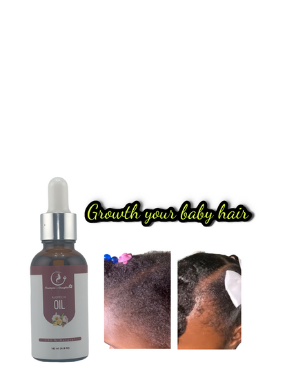 Alopecia Oil”, a 100% natural formula. It comes in a (1.5oz) bottle with a dropper top for application