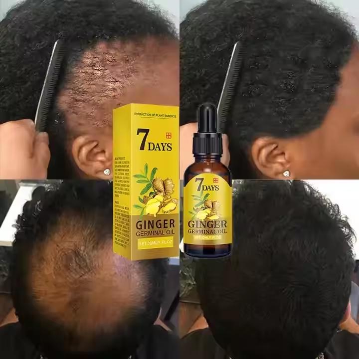 Ginger oil