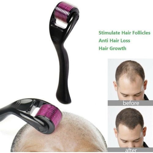 Hair loss