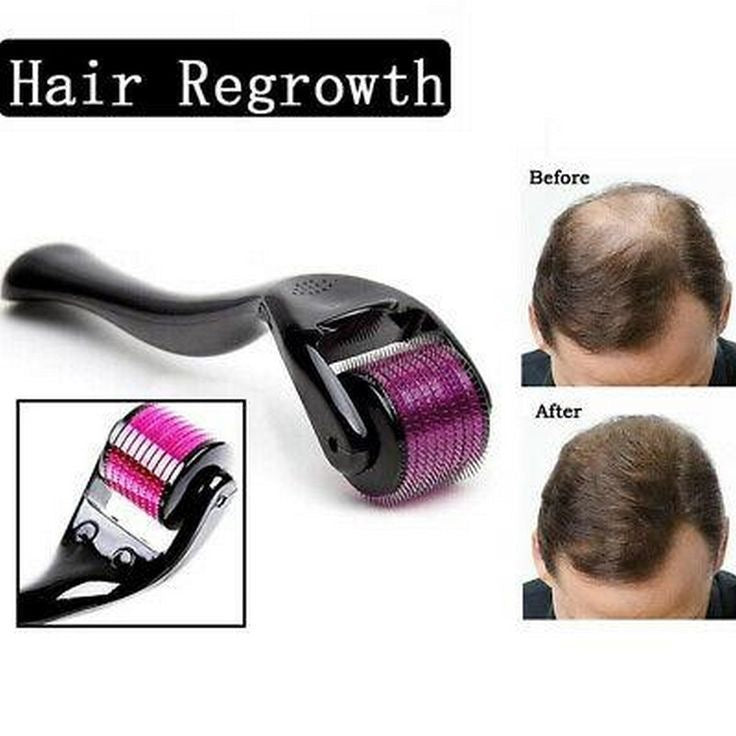 Hair loss